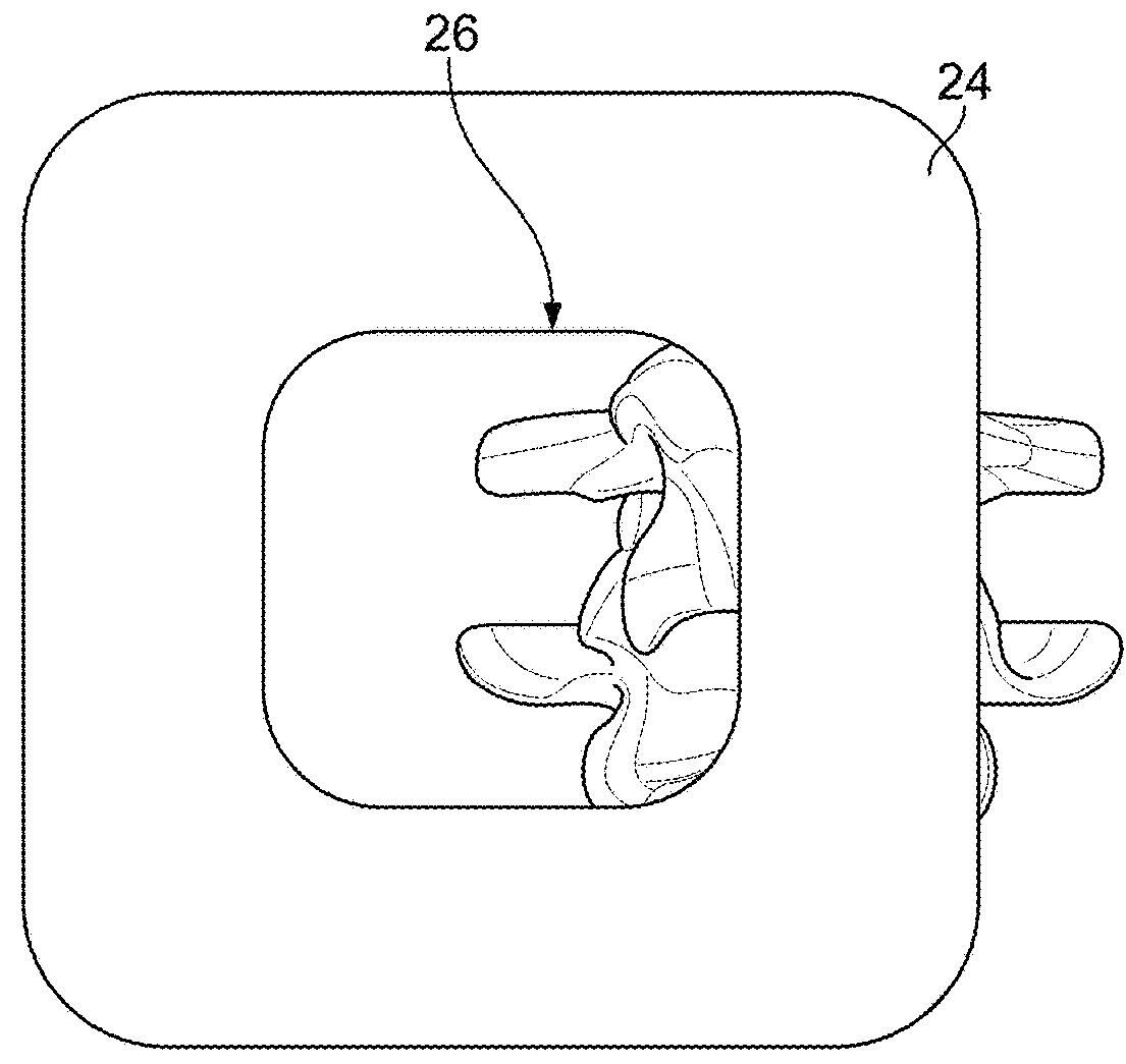 Minimal Impact Access System To Disc Space