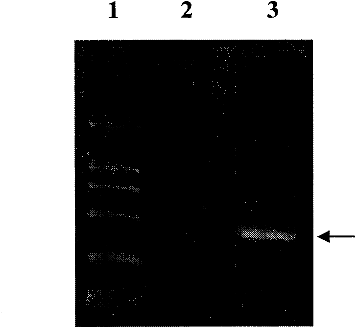 Lung cancer DNA plasmid vaccine and preparation method thereof