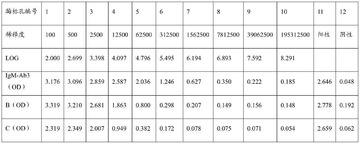 Anti-human igm monoclonal antibody, its hybridoma cell line and application