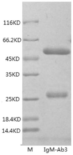 Anti-human igm monoclonal antibody, its hybridoma cell line and application