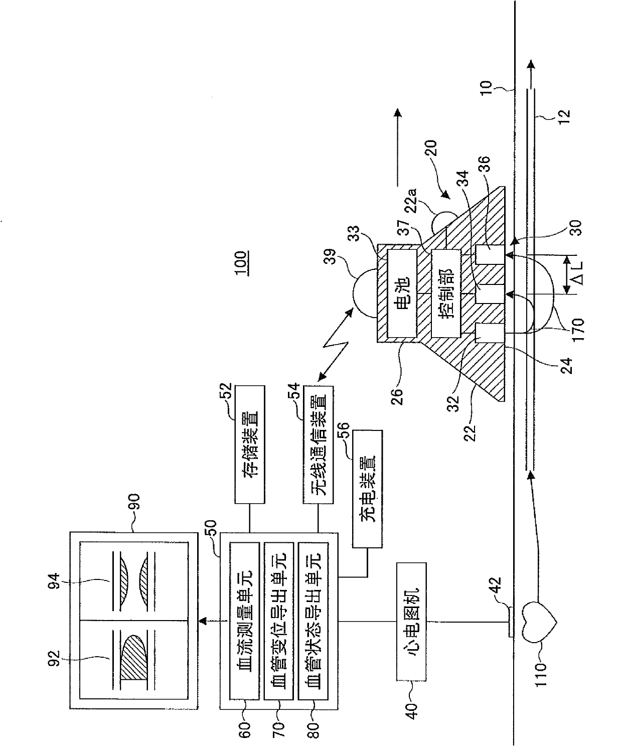 Blood vessel characteristics measurement device and method for measuring blood vessel characteristics