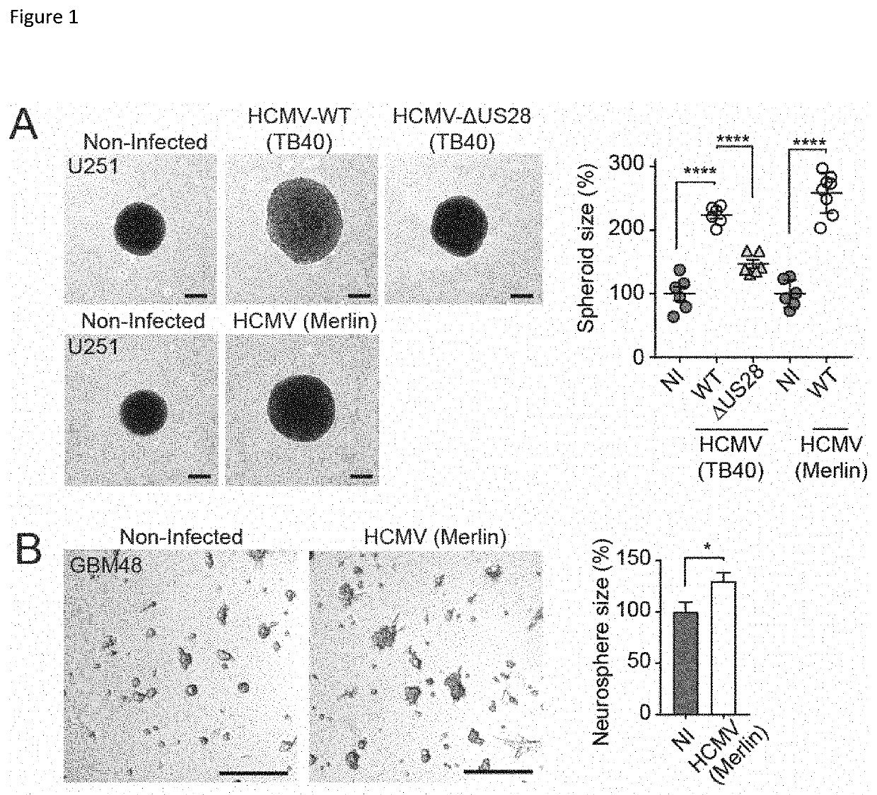 Inverse Agonistic Anti-US28 Antibodies