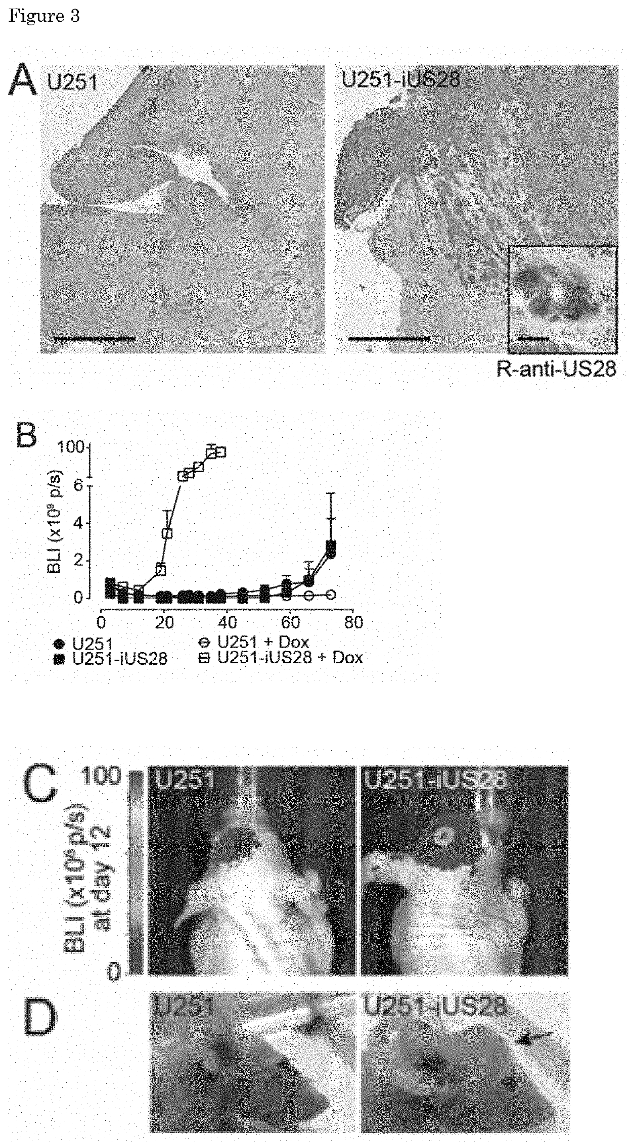 Inverse Agonistic Anti-US28 Antibodies