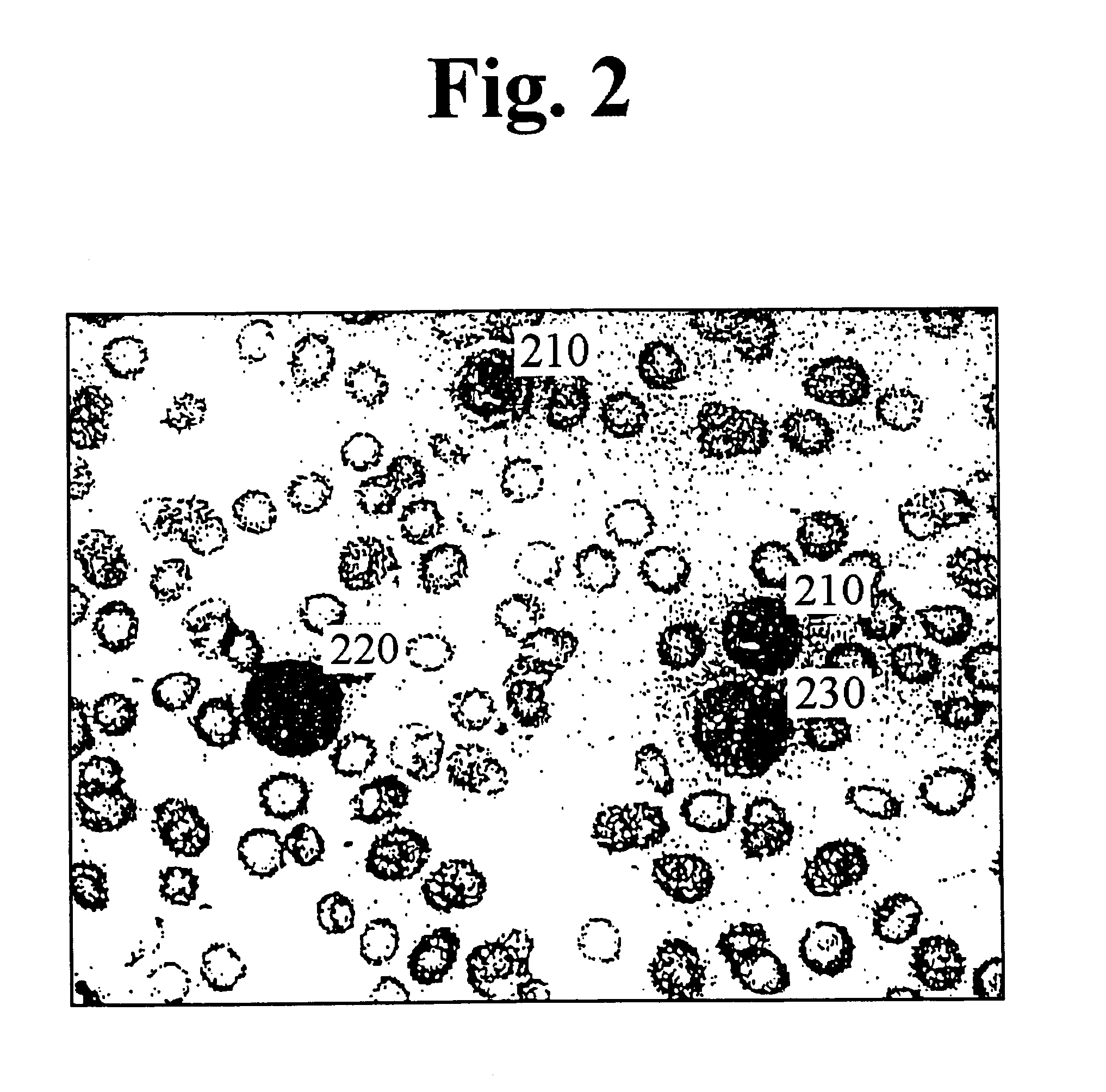 Method and apparatus for automatically recognizing blood cells