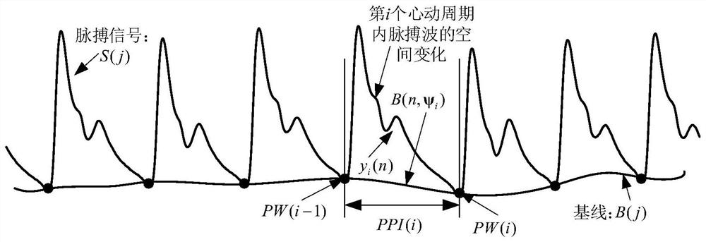 A system for judging age, health status and identifying malignant arrhythmia by combining time-space domain of pulse signal