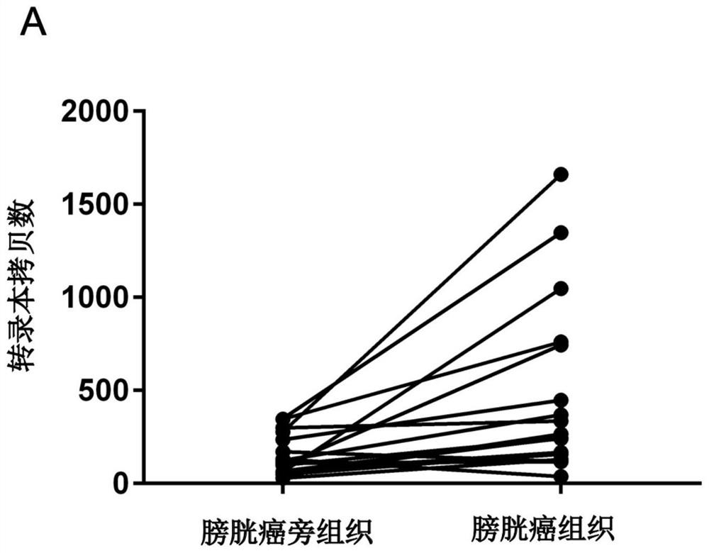 Novel tumor-associated transcription factor zscan16 and its application in tumor suppression