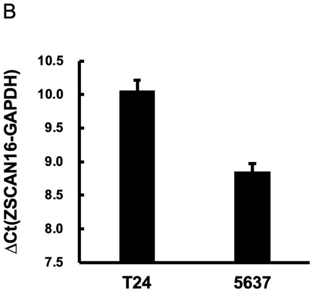 Novel tumor-associated transcription factor zscan16 and its application in tumor suppression