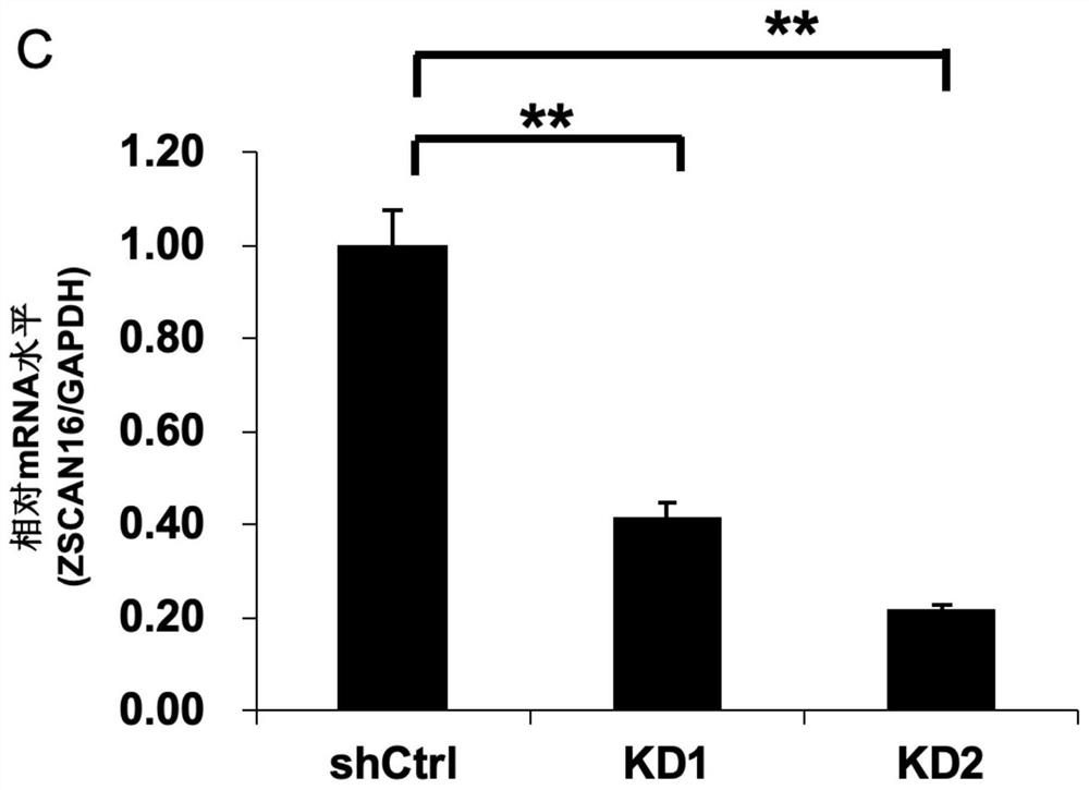 Novel tumor-associated transcription factor zscan16 and its application in tumor suppression