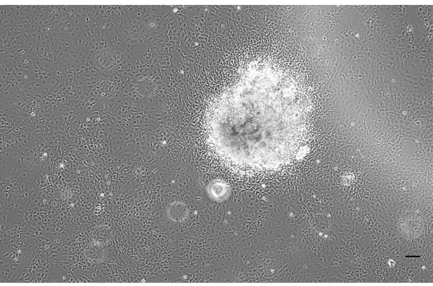 Pomfret muscle tissue cell line