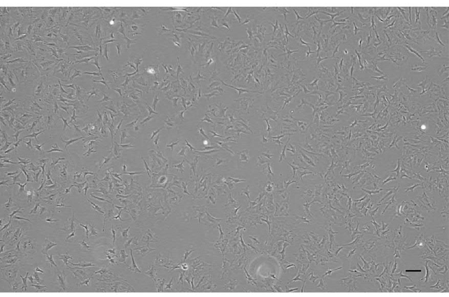 Pomfret muscle tissue cell line