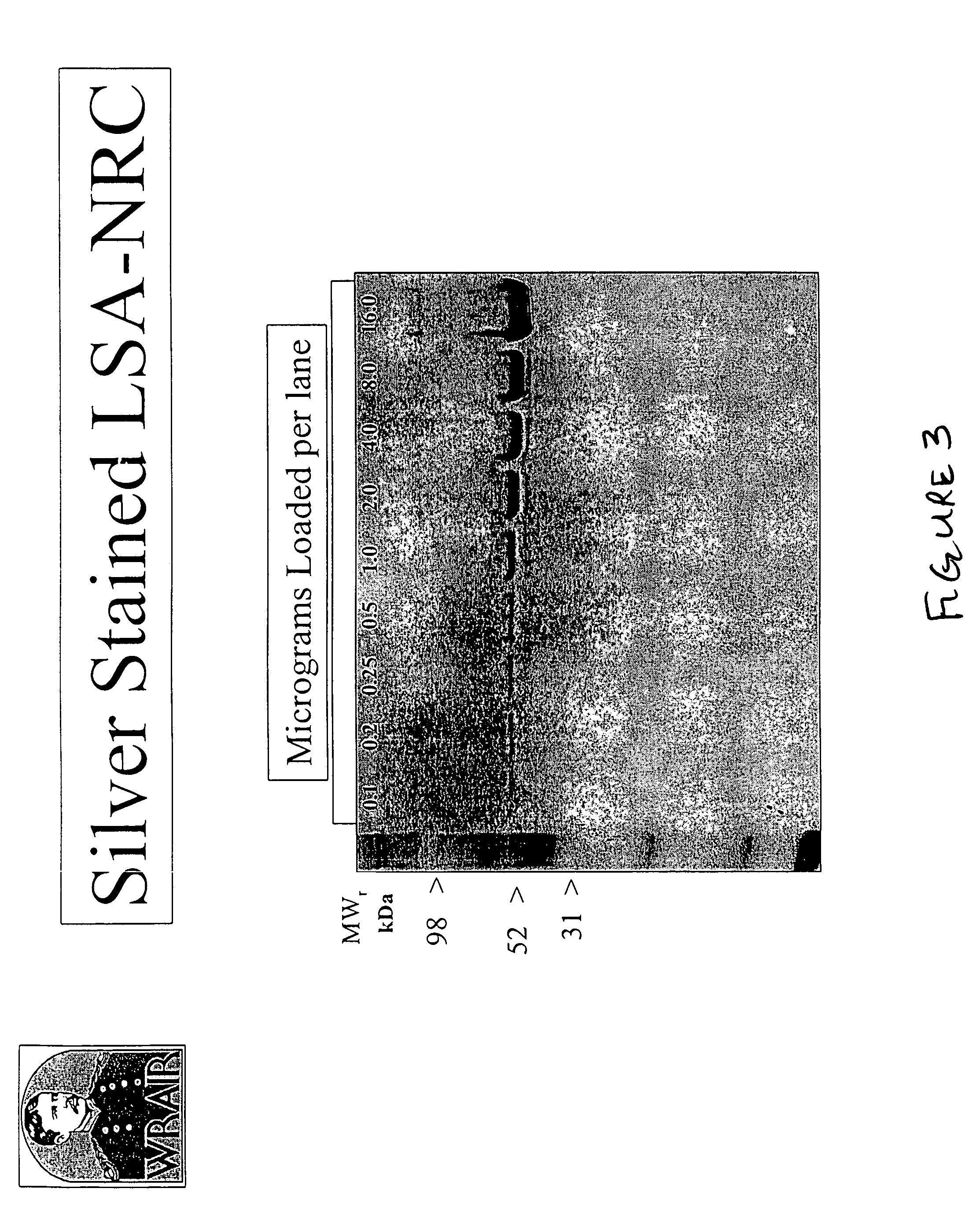 Expression, purification and uses of a Plasmodium falciparum liver stage antigen 1 polypeptide