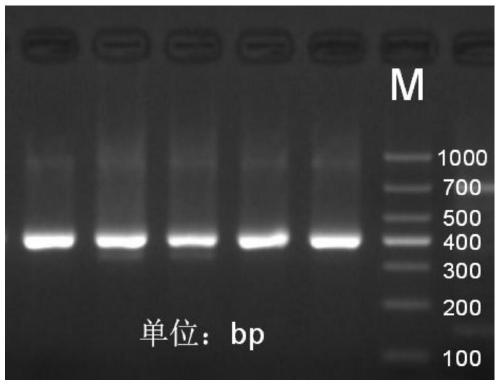 Method for detecting folic acid metabolism related gene mutation through combination of overlap extension PCR and Sanger sequencing