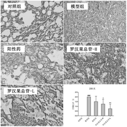 Application of Monk Fruit Extract in Anti-pulmonary Fibrosis