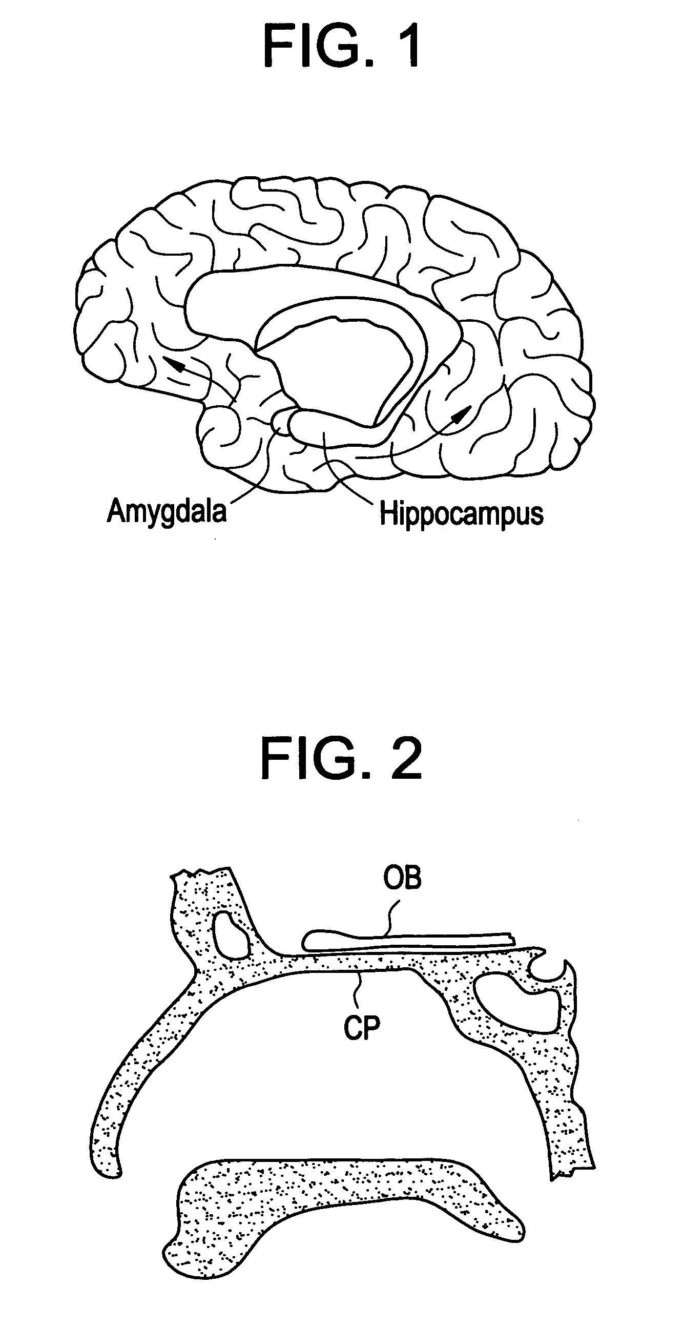 Intranasal red light probe for treating Alzheimer's disease