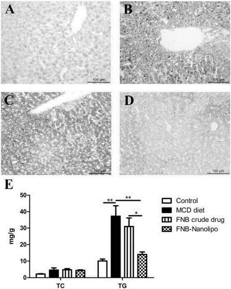 Fenofibrate-containing nano-liposome as well as preparation method and application thereof