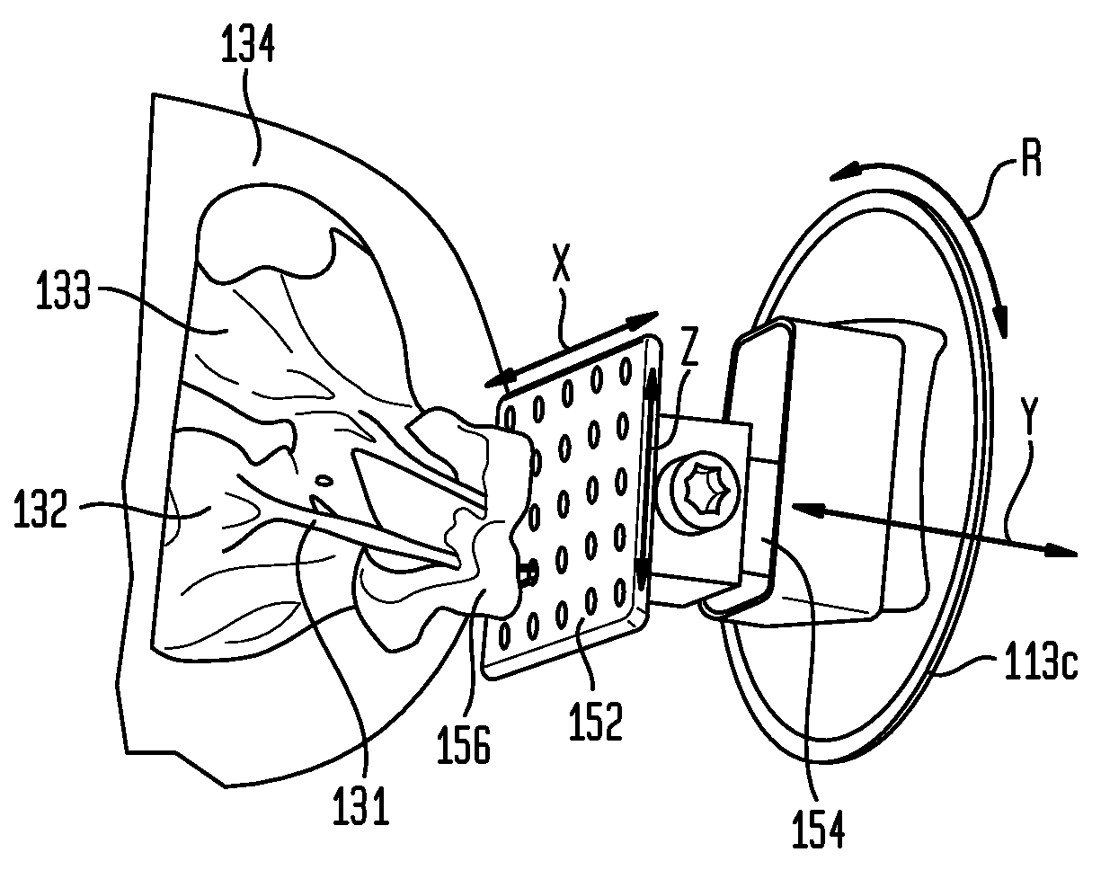 Simulated environment for transcatheter heart valve repair