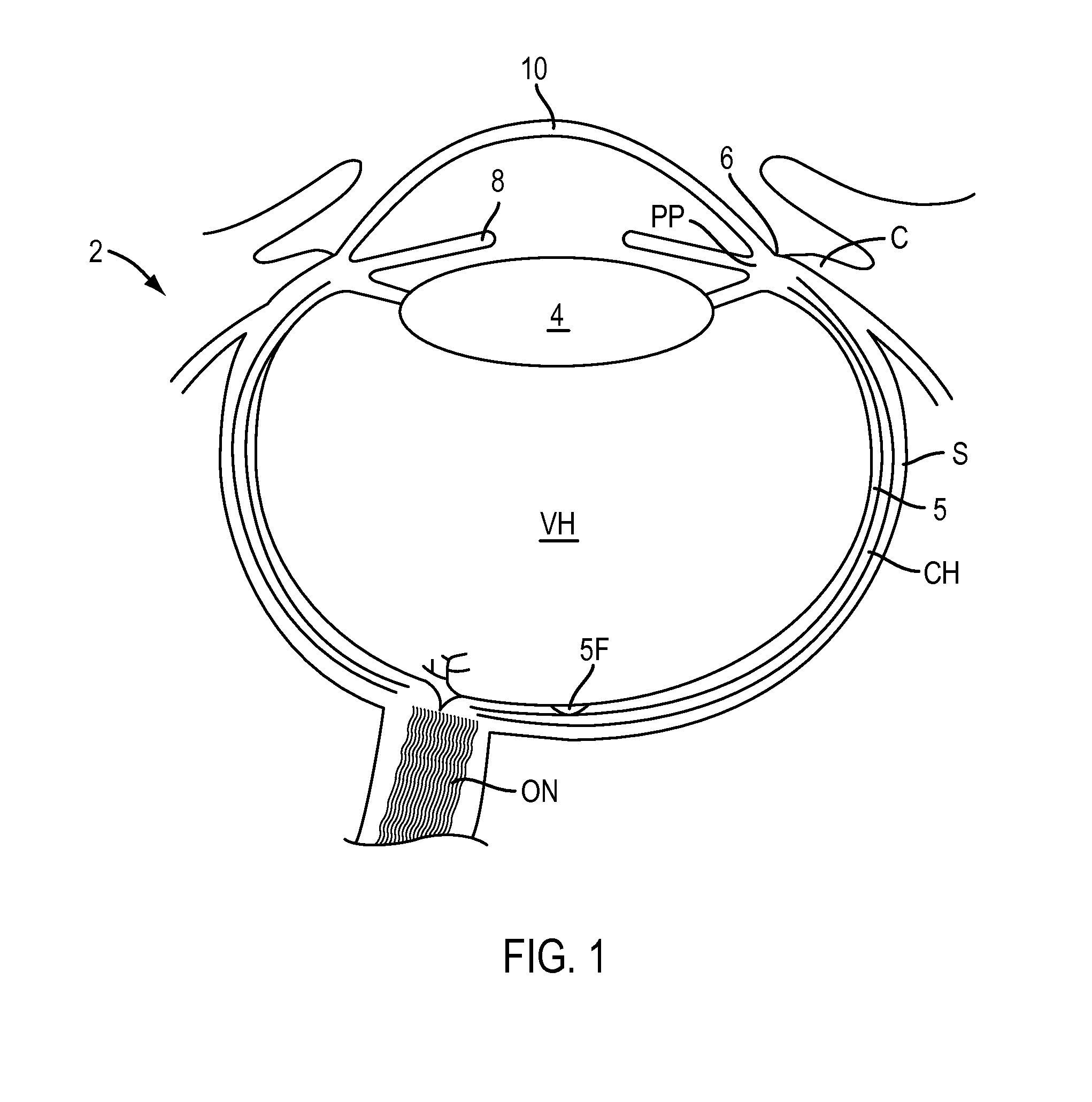 Eye covering and refractive correction methods and apparatus having improved tear flow, comfort, and/or applicability