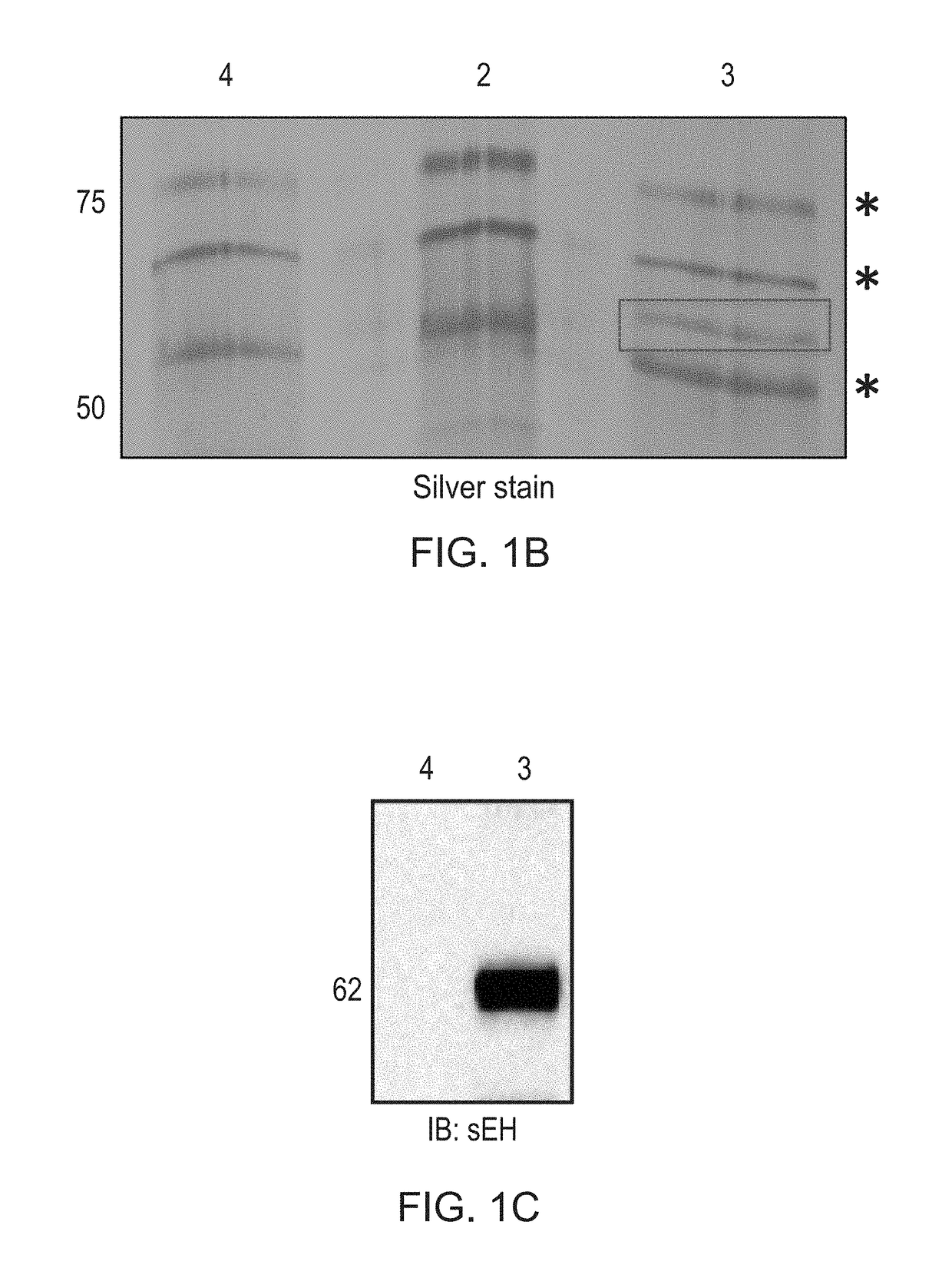 Soluble epoxide hydrolase as a target for ocular neovascularization