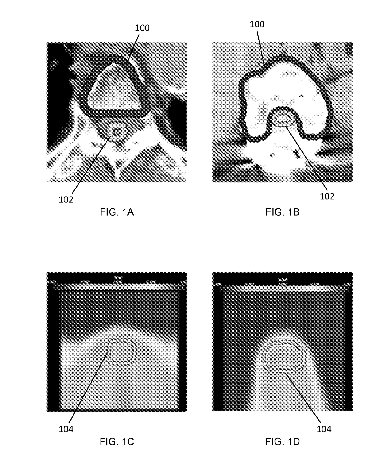 Systems and methods for automated radiation treatment planning with decision support