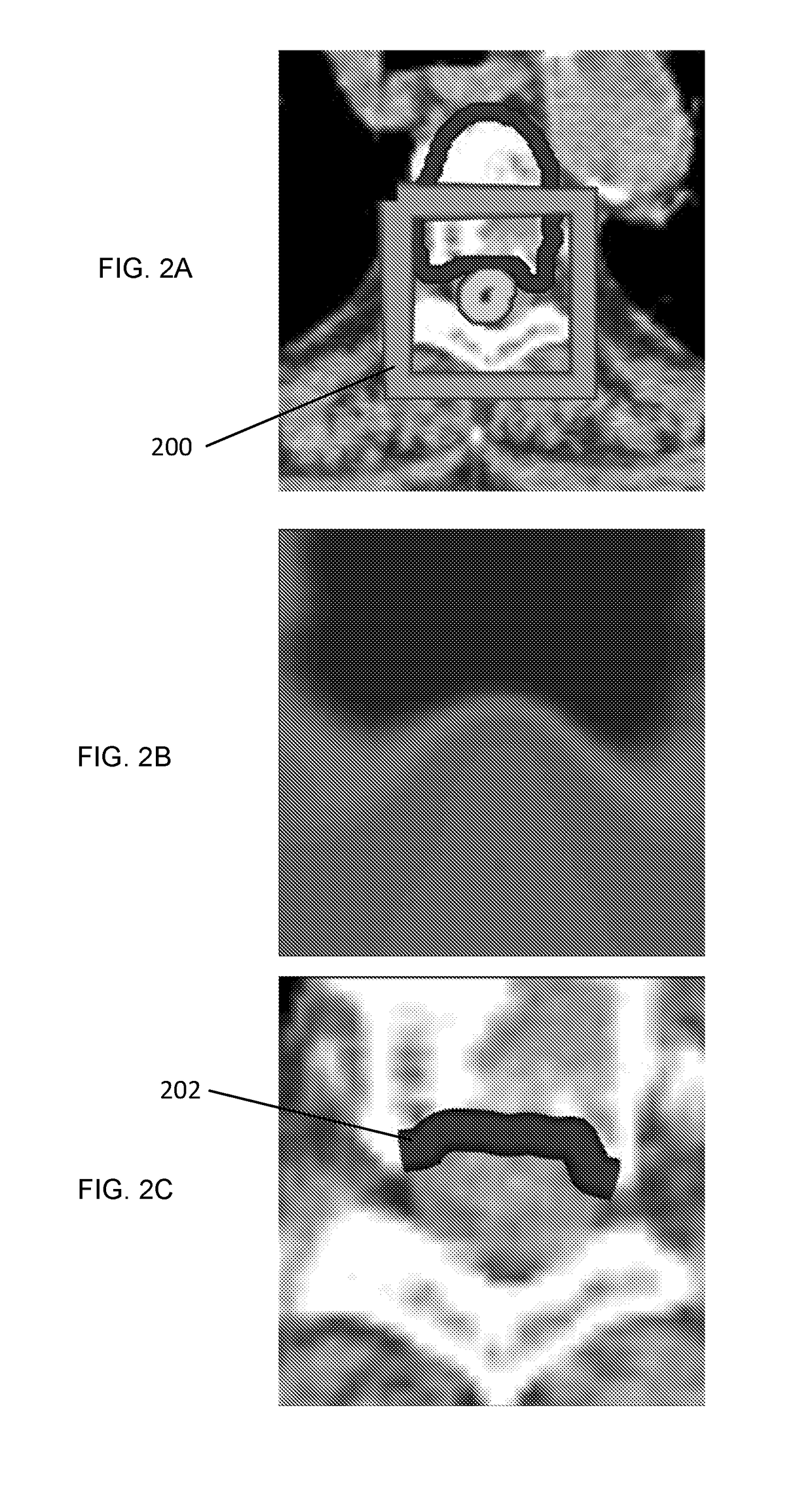 Systems and methods for automated radiation treatment planning with decision support