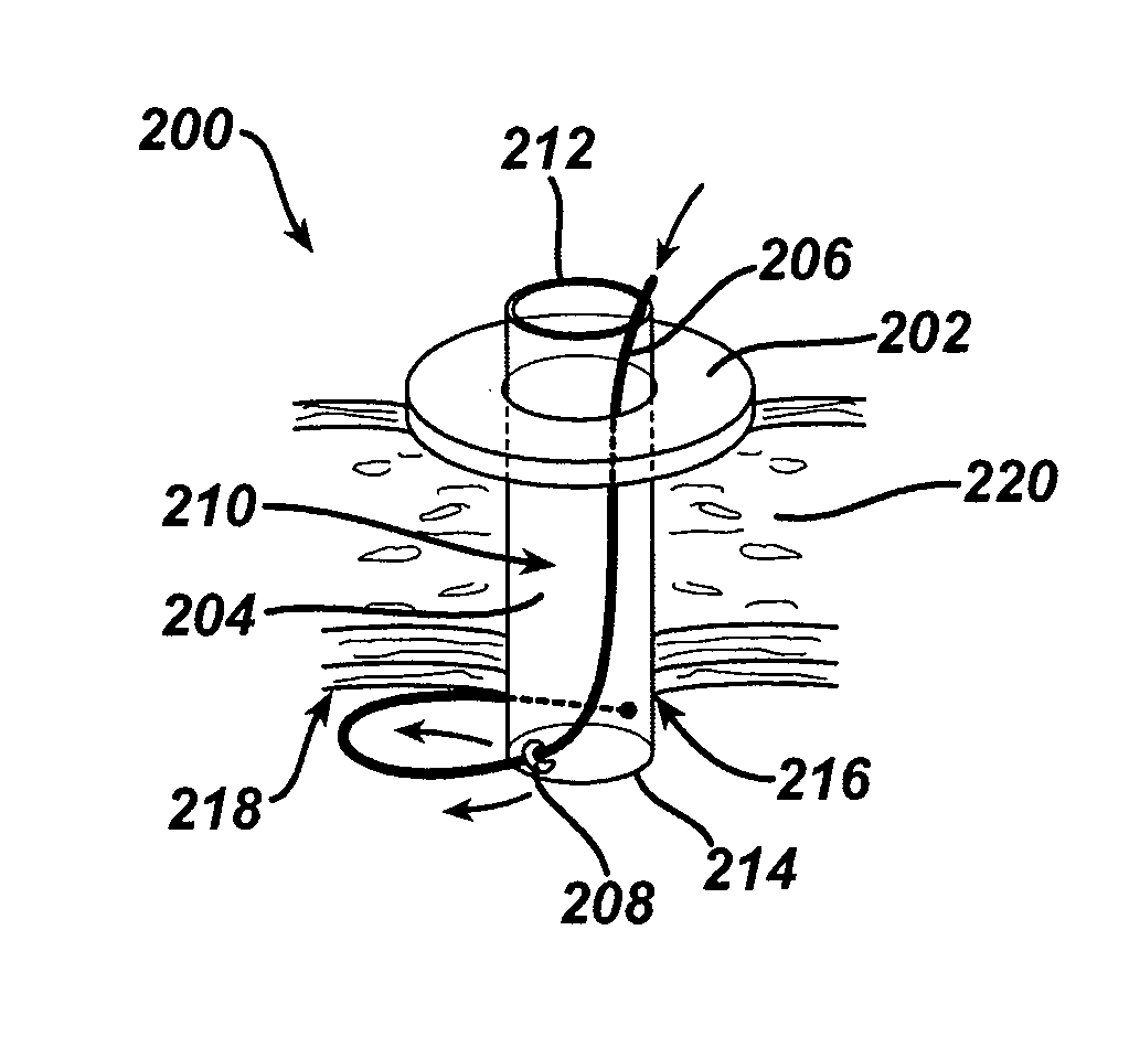 Methods and Devices for Providing Access into a Body Cavity