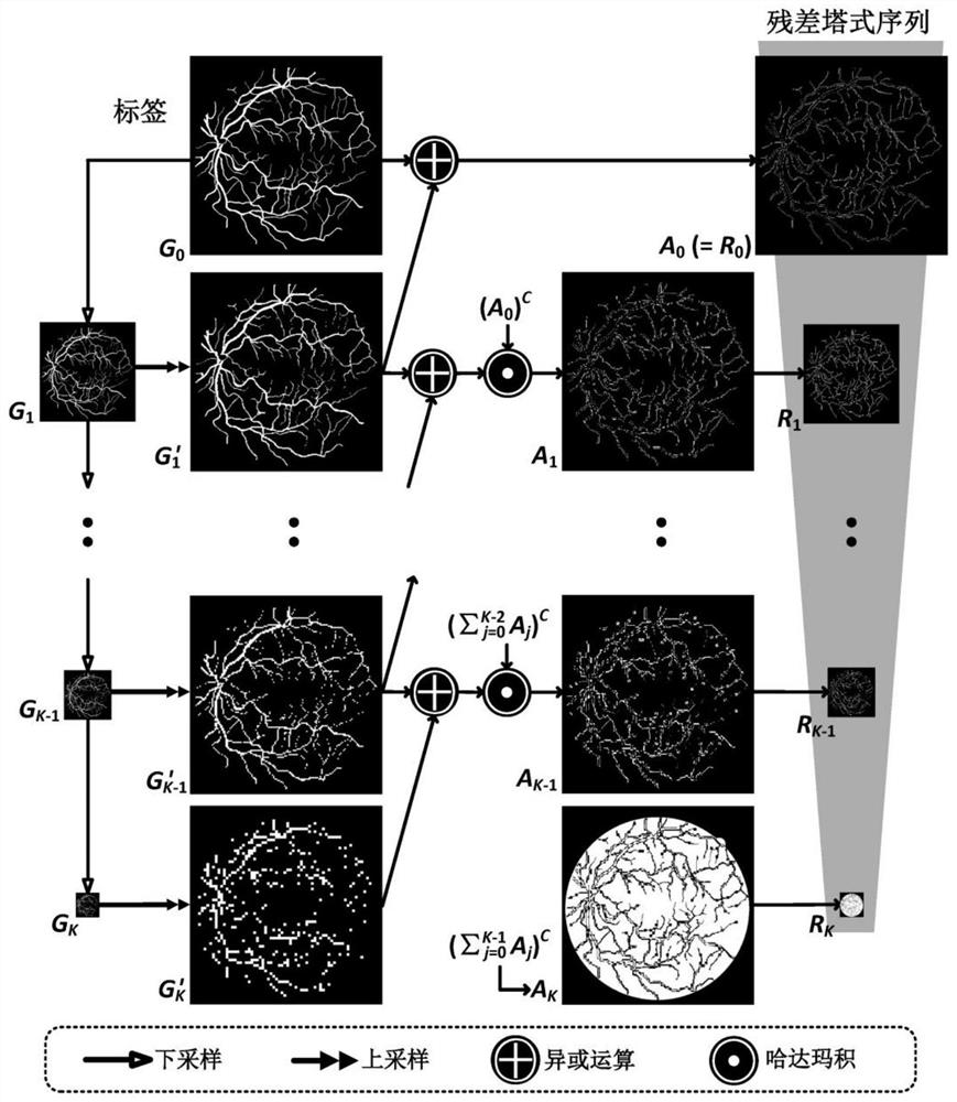 Fundus image blood vessel segmentation method based on shared decoder and residual error tower type structure