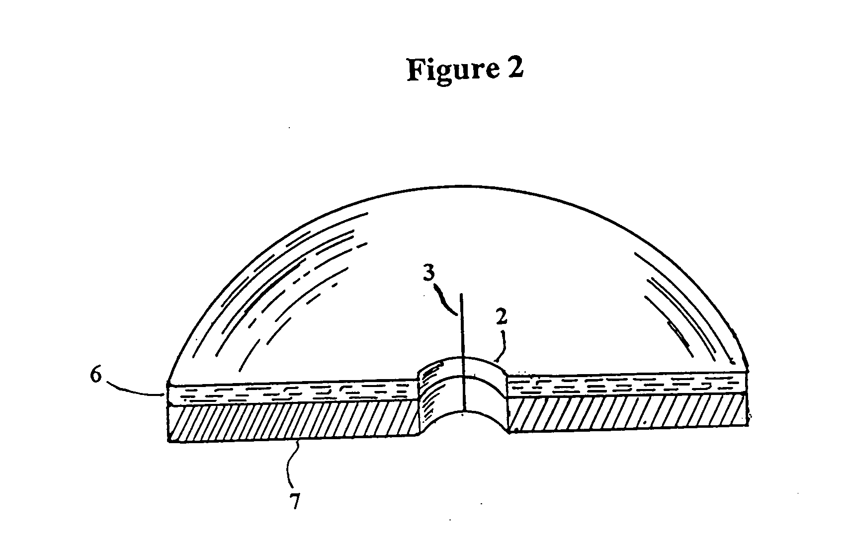 Catheter patch