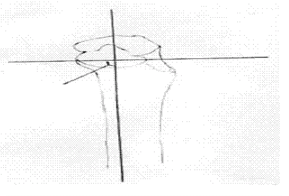 Method for manufacturing navigation template for knee replacement, and navigation template