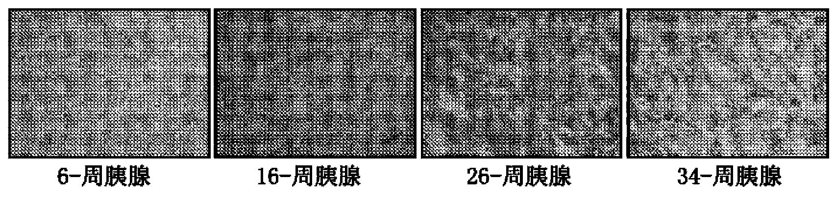 Tumor specific antibodies and uses therefor