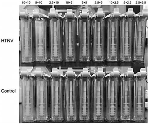 Nucleic acid set, kit and detection method for detecting Hantaan viruses through RPA (recombinase polymerase amplification)