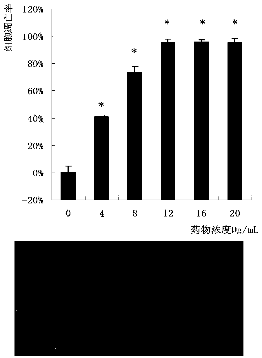 Black fungus protein extract and anti-tumor application thereof