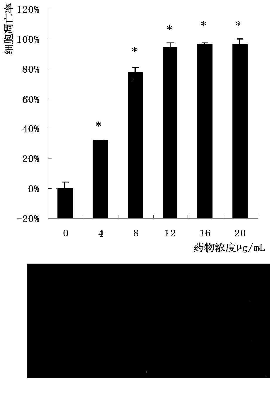 Black fungus protein extract and anti-tumor application thereof