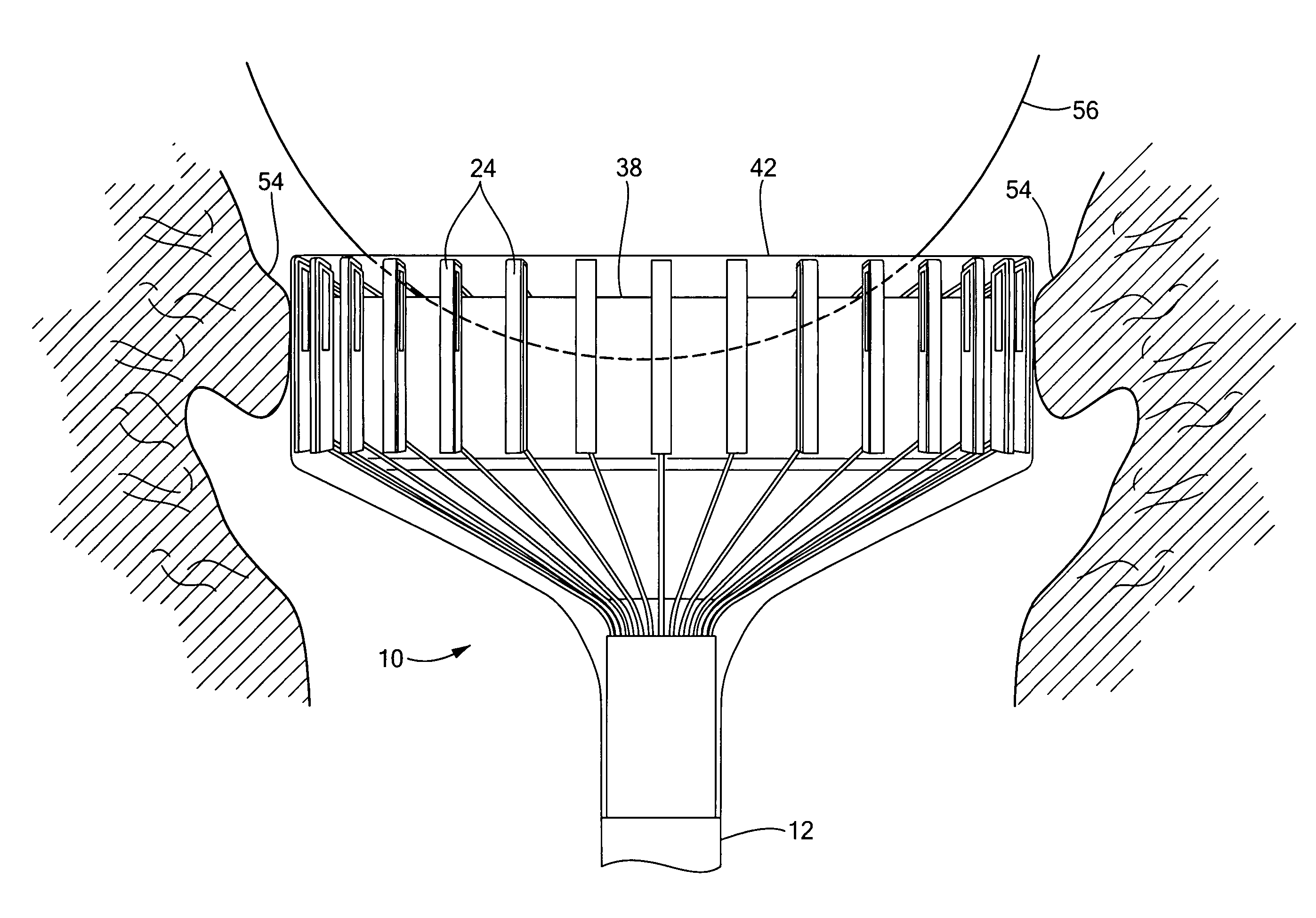 Method for cervical dilation and/or measurement