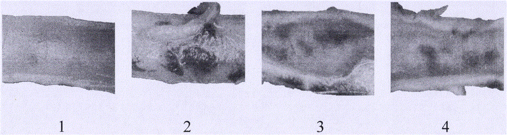 Pharmaceutical composition for preventing atherosclerosis and application thereof