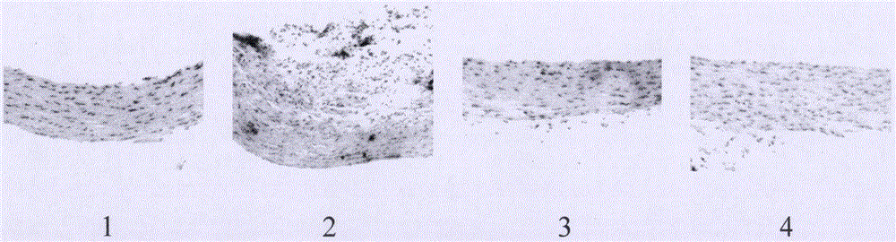 Pharmaceutical composition for preventing atherosclerosis and application thereof