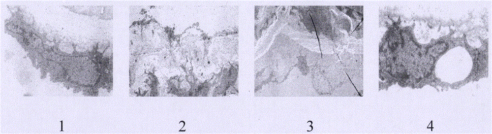 Pharmaceutical composition for preventing atherosclerosis and application thereof