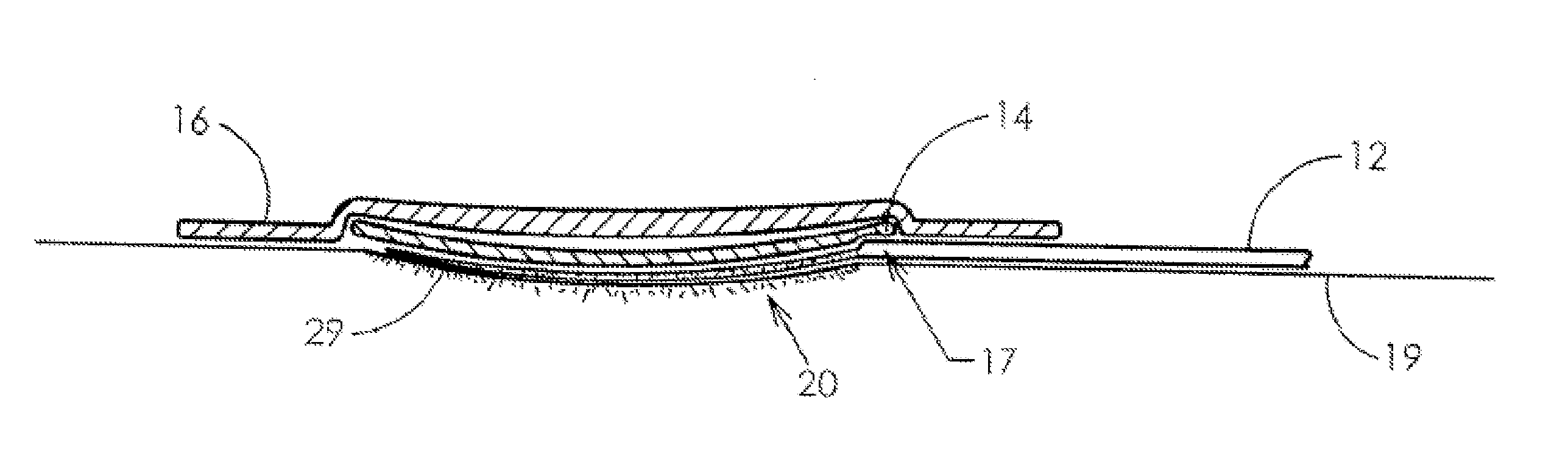 Apparatus and methods for controlling tissue oxygenation for wound healing and promoting tissue viability