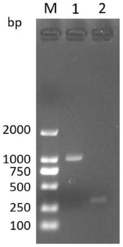 Method for Quantitatively Detecting the Titer of Recombinant Lentivirus