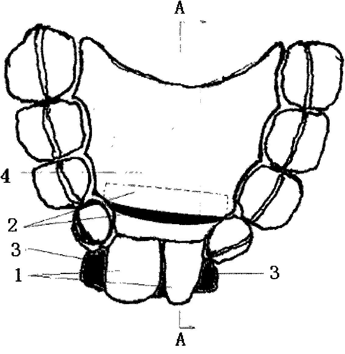 Tooth magnetic force correction method