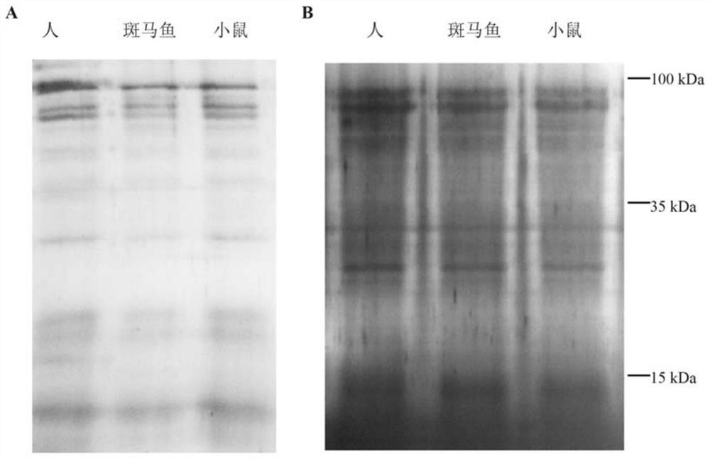 Marker protein related to asthenospermia and application of marker protein