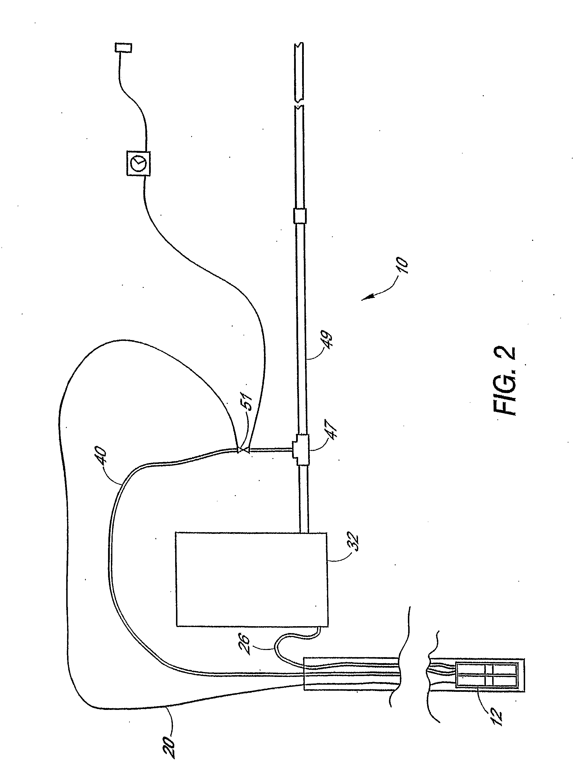 Method and system for filtering sediment-bearing fluids