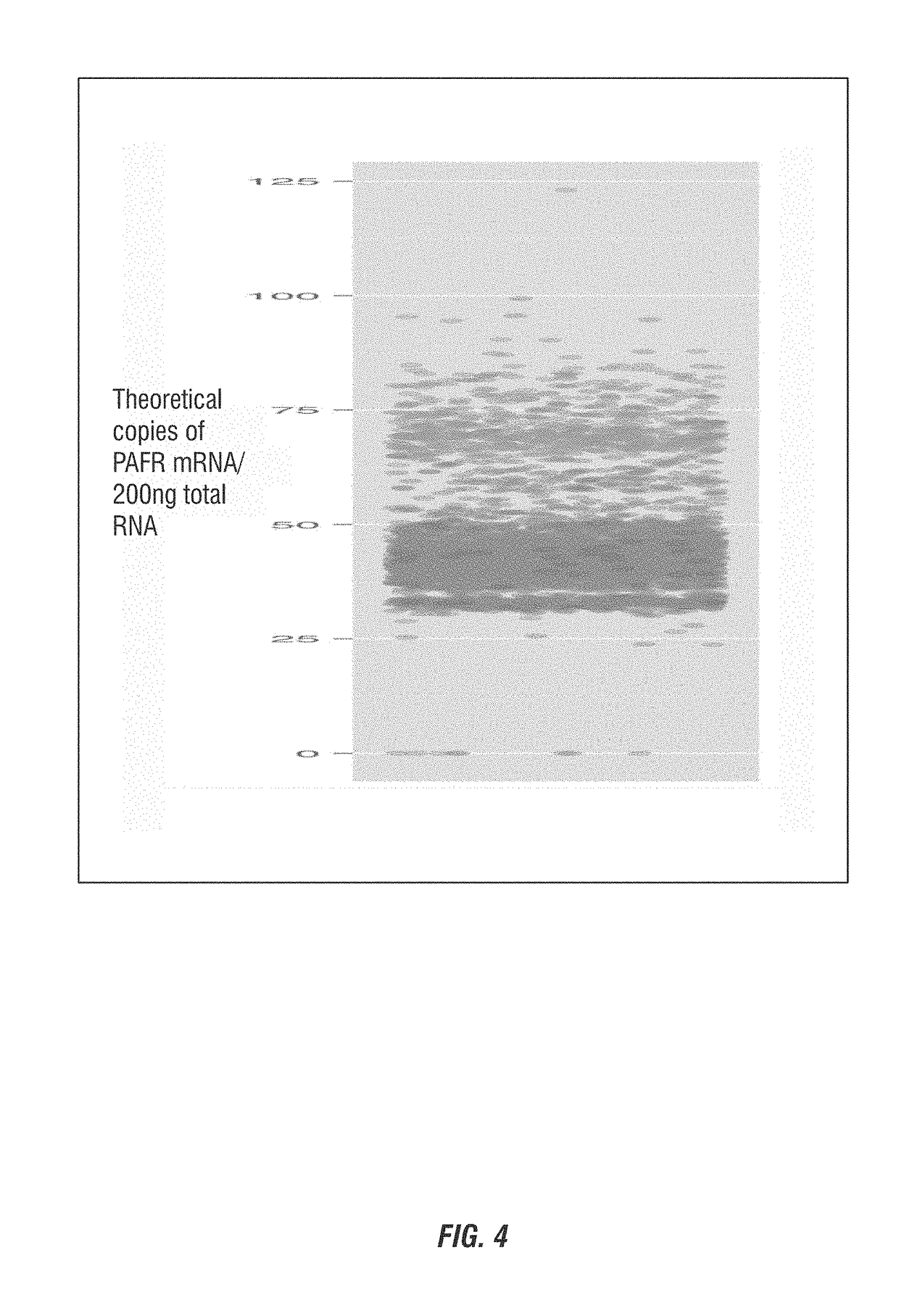 Methods and compositions for prevention of feedlot bovine respiratory disease