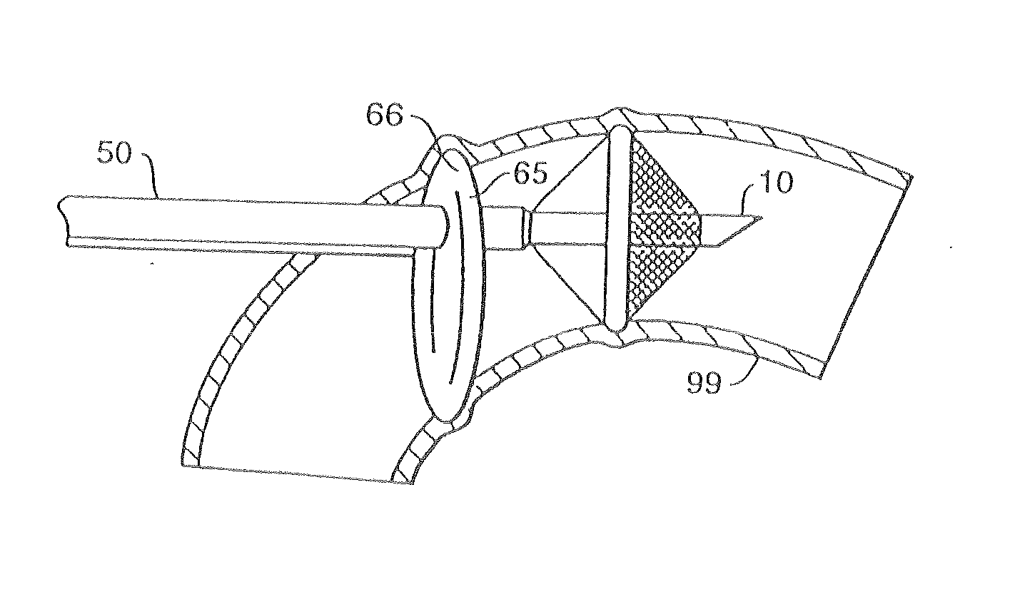 Aortic occluder with associated filter and methods of use during cardiac surgery