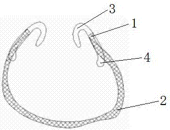 Mouth gag for preventing and controlling microstomia deformity caused by scar contracture after burns