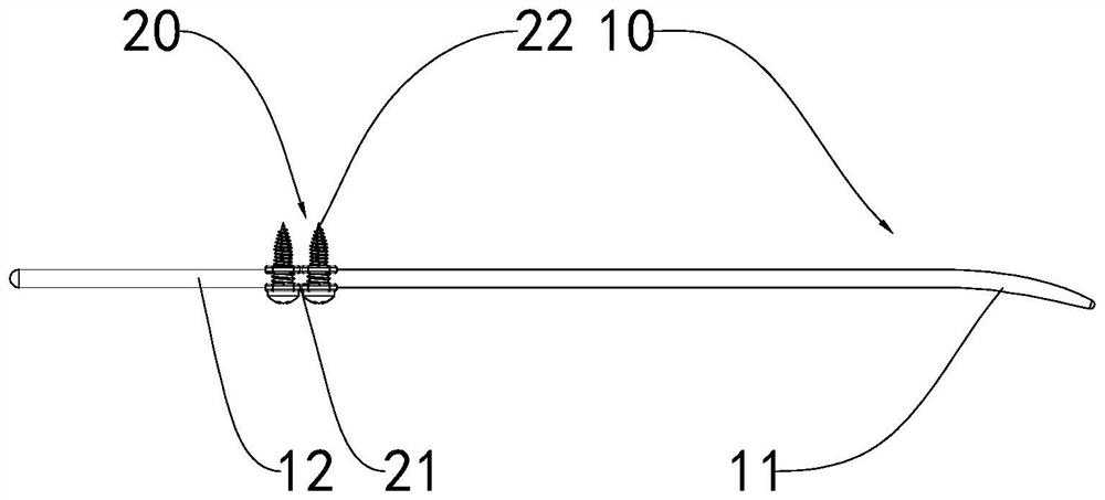 Intramedullary locking needle with terminal extramedullary locking function