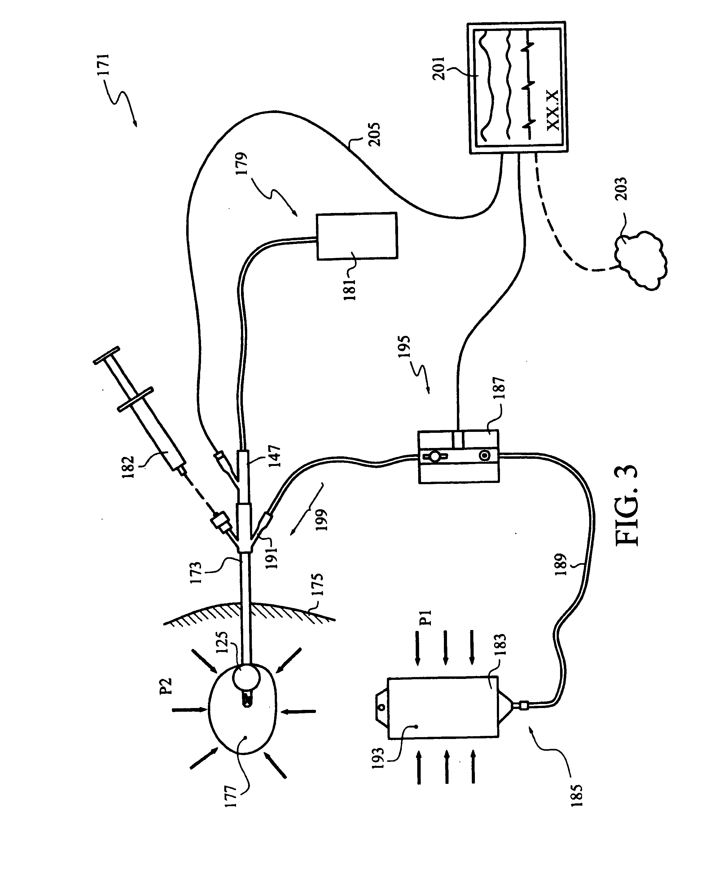 Continuous Intra-Abdominal Pressure Monitoring Urinary Catheter With Optional Core Temperature Sensor