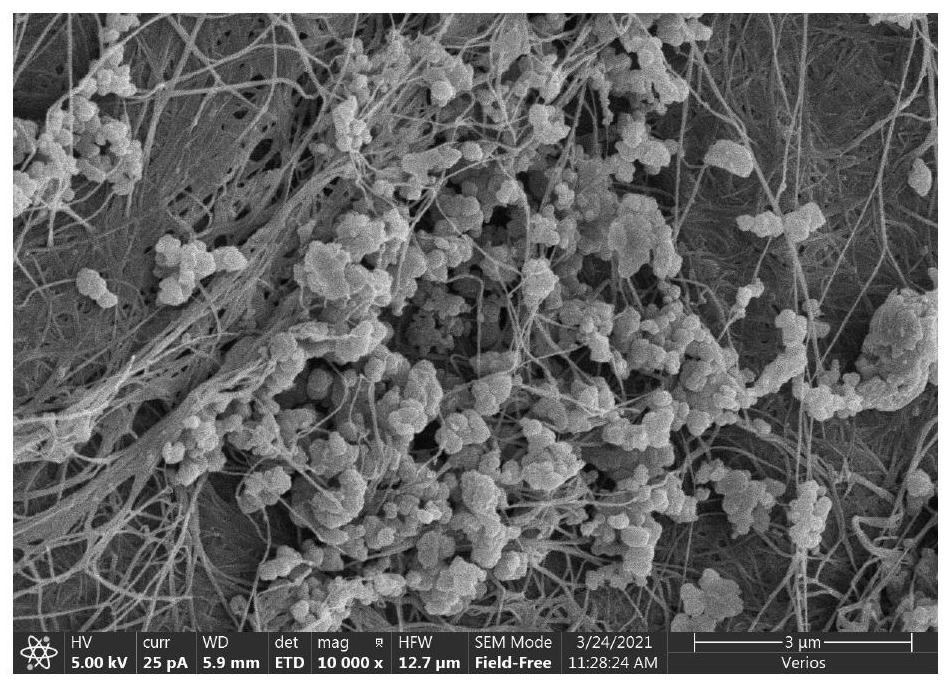 Preparation method of photo-thermal sensitive composite bacterial cellulose antibacterial dressing