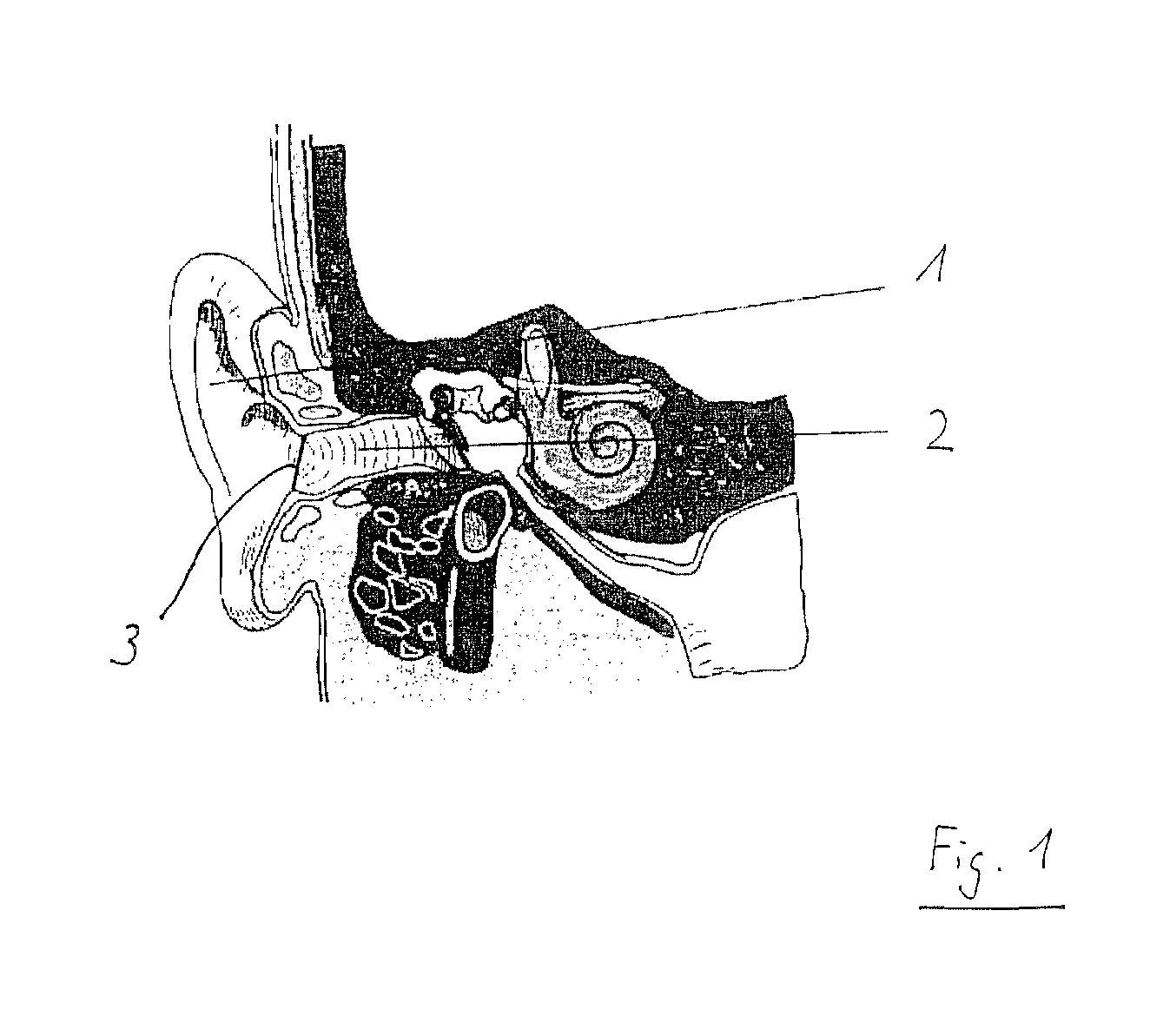 Device for applying a transcutaneous stimulus or for transcutaneous measuring of a parameter