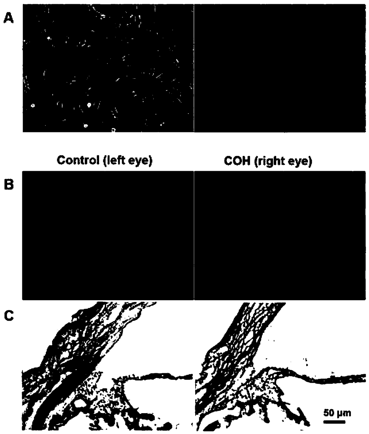 Chronic glaucoma animal model establishing method and application thereof