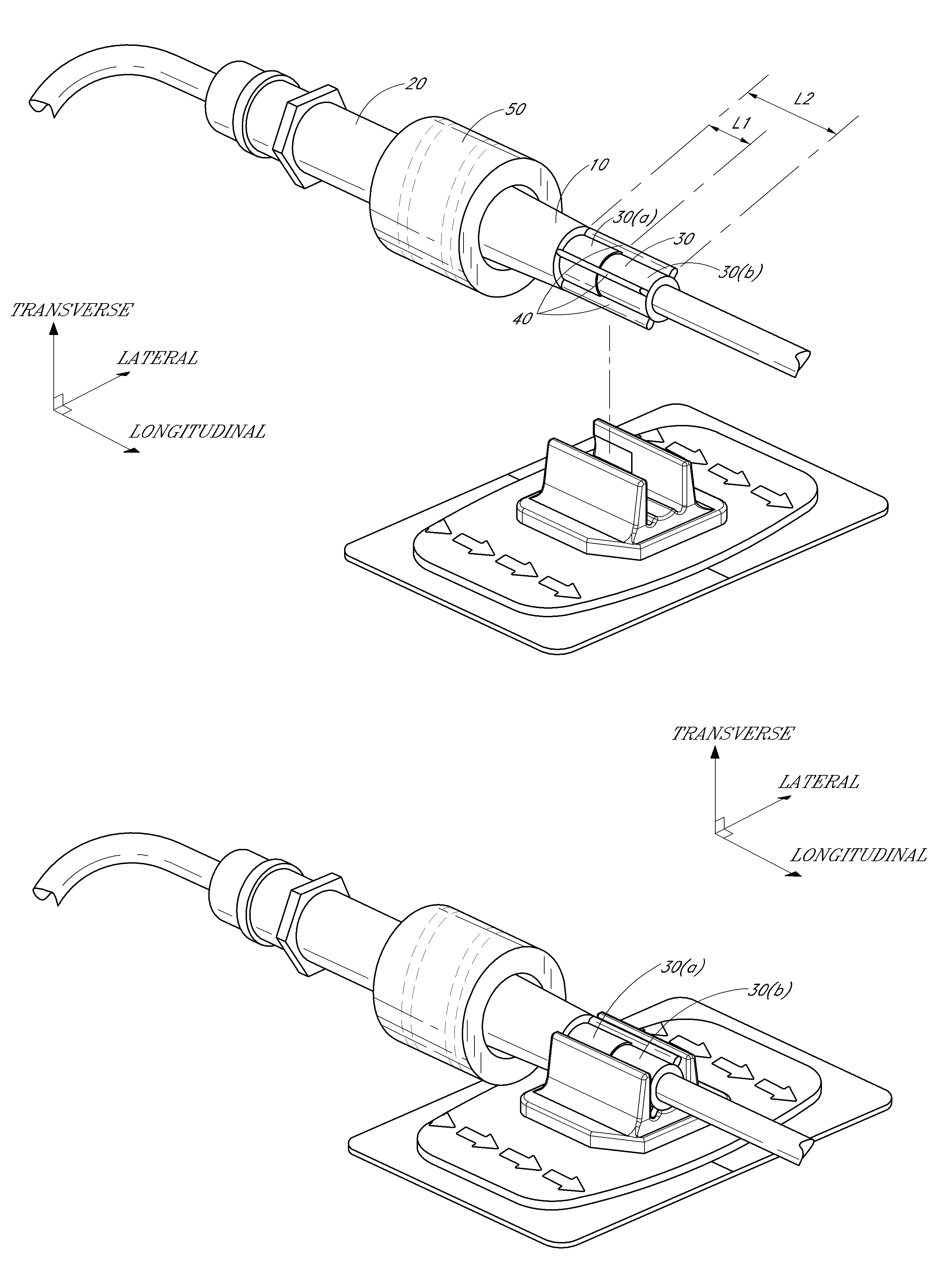 Catheter securement device